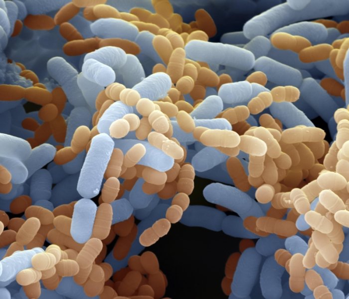 © Eligo Bioscience