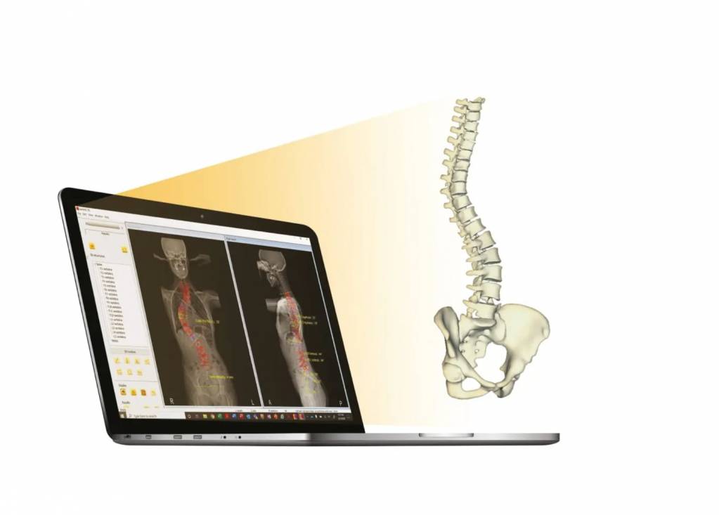 EOS Imaging EOS Imaging