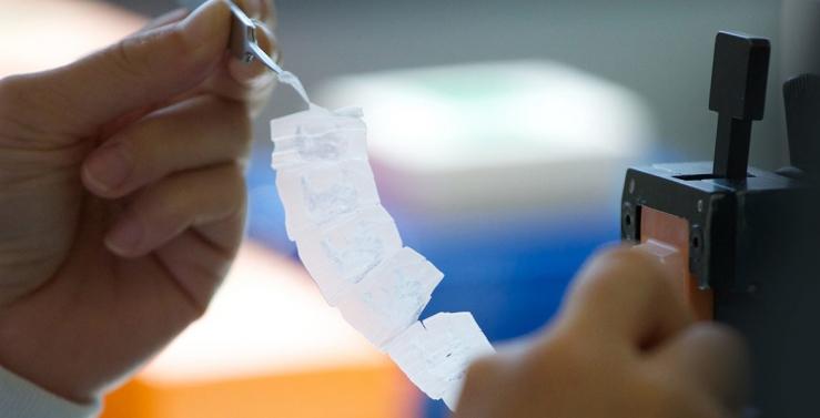 © HalioDx © HalioDx