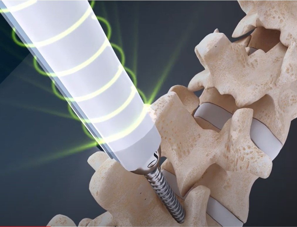 ©Safe Group ©Safe Group