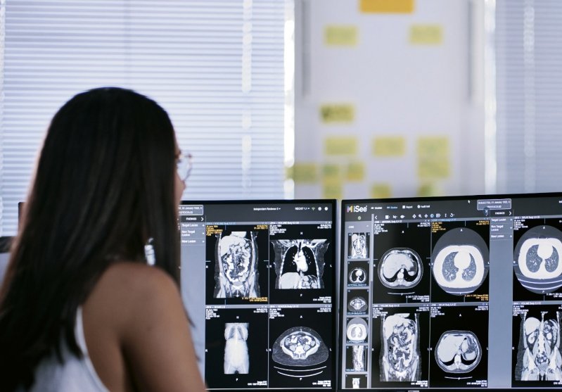 © Median Technologies © Median Technologies