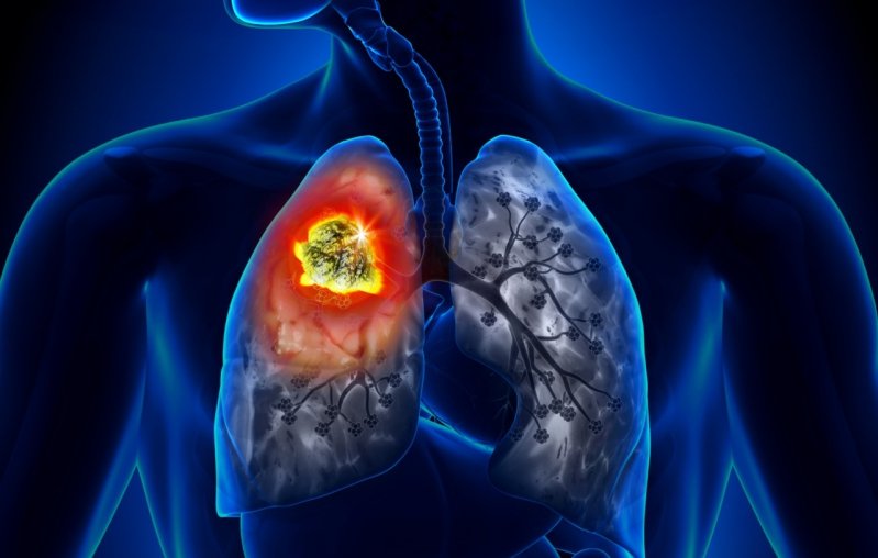 © Adobe Stock © Adobe Stock