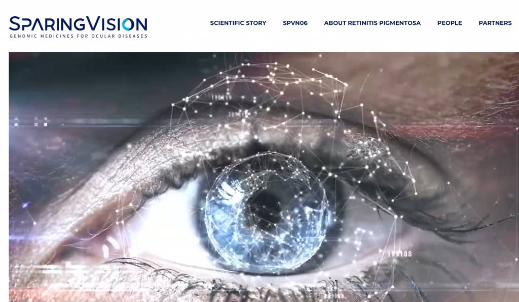 SparingVision SparingVision