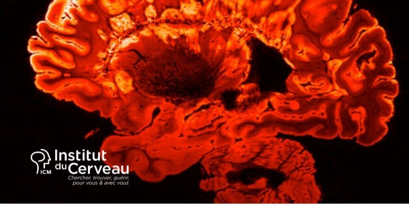 © Institut du Cerveau © Institut du Cerveau