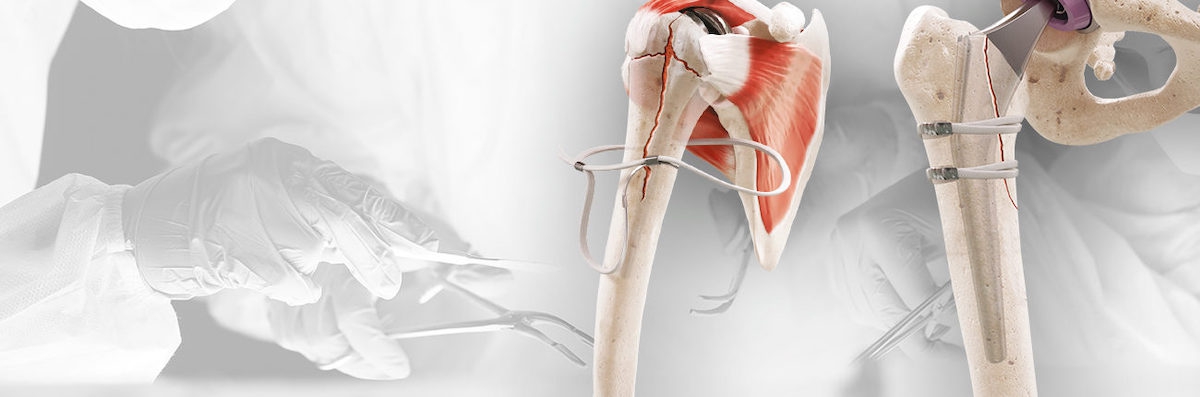 © FH Ortho © FH Ortho