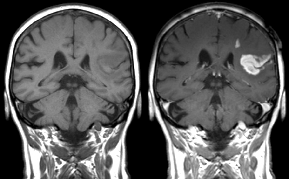 &copy; wikimedia.org