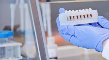 © Neogene Therapeutics