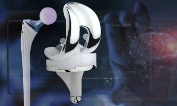 ©Amplitude Surgical