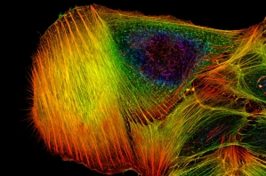 Imagerie moléculaire d'une cellule cancéreuse